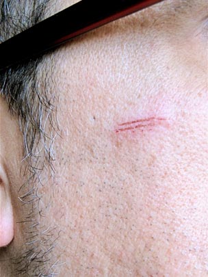  ANDREU BUENAFUENTE _ marcado 