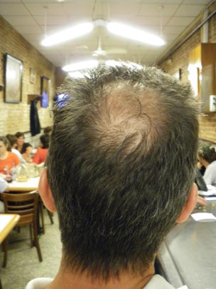  PAU ARENÓS _ deforestación 