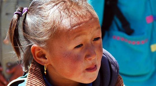  ARACELI SEGARRA _ dry skin 