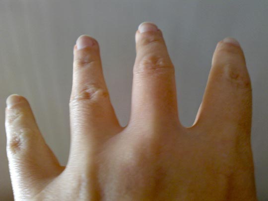  BERTO ROMERO _ cresta 