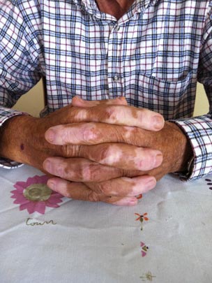  BERTO ROMERO _ manos de camuflaje 