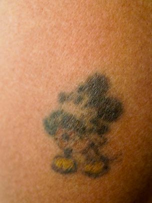  BERTO ROMERO _ mickey en la piel 