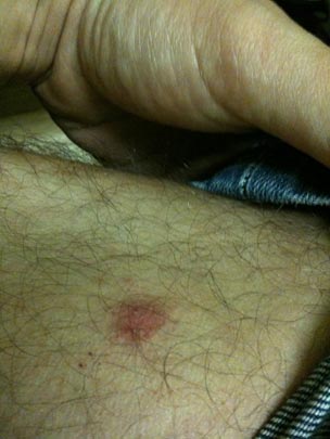  BERTO ROMERO _ picotazo 