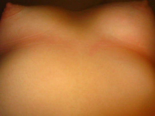  MIKEL URMENETA _ dos 